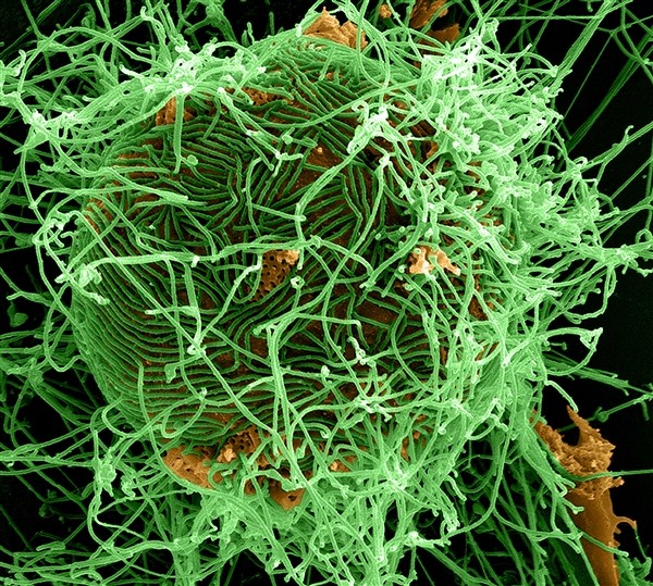 A digitally colorized scanning electron micrograph depicts numerous filamentous Ebola virus particles in green, budding from a chronically infected VERO E6 cell in orange at 25,000X magnification. (Courtesy of National Institute of Allergy and Infectious Diseases/Released)