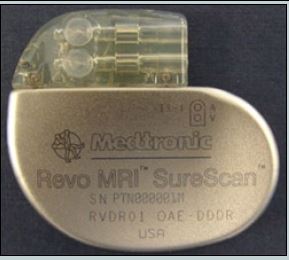 The Revo MRI SureScan Pacing System delivers standard pacing t h e r a p y t o patients with slow heart rates. This p a r t i c u l a r p a c e m a k e r permits patients meeting certain criteria to receive M R I s c a n . (Courtesy of the U . S . F D A / Released)