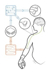 Figure 1: Schematic of a somatosensory neuroprosthesis. Signals from touch sensors on the prosthetic hand (orange arrows/traces) are converted into patterns of electrical stimulation (blue pulse trains/arrows) delivered to the nerve (for amputees) or to the brain (for tetraplegic patients). (Released)