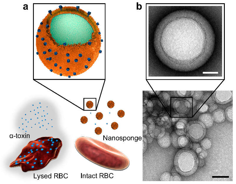 Figure 2. Biomimetic nanosponges for pore-forming toxin neutralization. (a) Under normal circumstances, hemolytic toxins such as staphylococcal α-toxin can attack RBCs and cause lysis. When nanosponges are introduced, these nanodecoys neutralize the toxins and leave the RBCs intact. (b) Transmission electron micrographs reveal the core–shell structure of the nanosponges (top scale bar = 20nm; bottom scale bar = 80nm) [6]. (Reprinted with Permission)