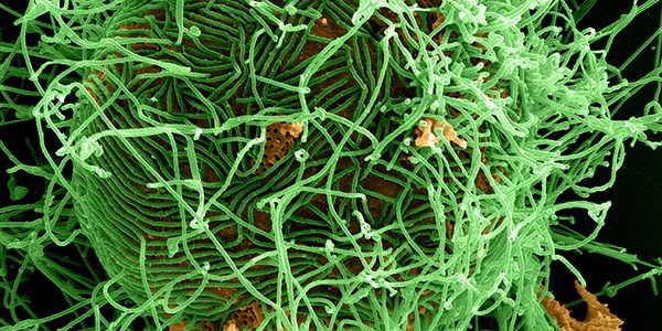 A digitally colorized scanning electron micrograph depicts numerous filamentous Ebola virus particles in green, budding from a chronically infected VERO E6 cell in orange at 25,000X magnification. (Courtesy of National Institute of Allergy and Infectious Diseases/Released)