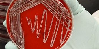 https://health.mil/News/Articles/2020/10/19/GEIS-Program-collaborates-to-combat-antibiotic-resistance