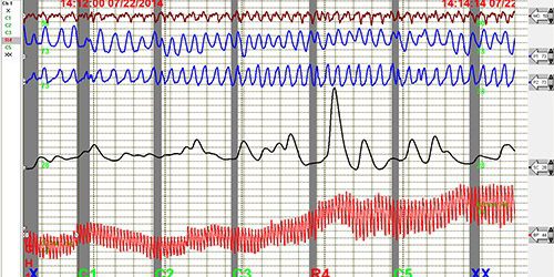 https://leb.fbi.gov/articles/featured-articles/the-concealed-information-test-an-alternative-to-the-traditional-polygraph